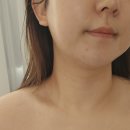 영스킨샵