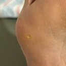 사상패디플래닝 더유포리아뷰티 발각질관리 후기