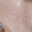 본에스테틱스킨&바디 이미지