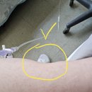 고려의료기상사 | 단국대병원_임신중독증/전자간증_응급출산