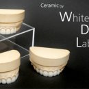 화이트치과기공소 이미지