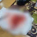 오월에 | [수술 후기] 오월에 마지막 충수염으로 병원생활