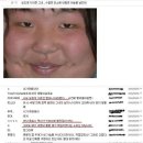 보조개 Daum카페