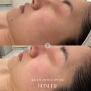 비앙리에