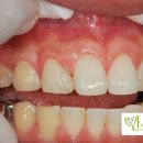 민치과기공소 이미지