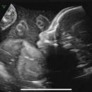 압구정함춘산부인과의원 이미지