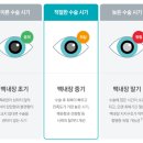A&J 안경콘텍트렌즈 | 노안수술 가격 후기 완벽 가이드: 최신 비용 분석 &amp; 실제 경험담