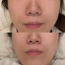 창조환경 | 노멀리즈에스테틱 창조경제단지점 | 대구 침산동피부...정밀진단으로 맞춤관리 에스테틱샵 산소테라피 후기