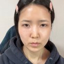 남4통 | 눈밑지 두 달 차 후기를 낉여보다...ꆤ.ꆤ☆