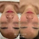 울산 남구피부관리 물광 스킨부스터 관리 후기 비앙리에