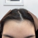 의정부 왁싱 모두올왁싱