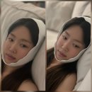 눈 성형 7번 배우 강예원, 이번엔 두턱 걱정…압박붕대 휘감은 근황 포착 이미지