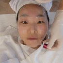 [마곡 문제성피부 관리] 편평사마귀, 여드름 다 없애버린 대만족 &#39;라인메이드 스킨케어&#39; 후기