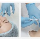 에시르의원 | 울산피부과 중요한 점은 레이저 출력이 강하다고 무조건 효과가 뛰어난 것은 아니에요