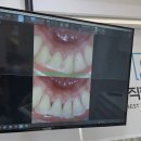 오류동 정직한이치과 스케일링 후기