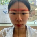 청담인한의원 | 청담 안면비대칭 한의원 1회 솔직후기