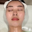 {찐찐 대림역 피부관리 후기} 프라이빗 스페셜 V라인 괄사관리 ‘엠제이뷰티/MJ뷰티’