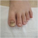 에스케어스 이미지