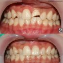 심미치과기공소 이미지