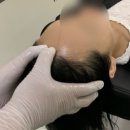 안전관리센터연구소 | 구월동 두피센터, 인천 여성 탈모관리 효과좋은 곳 추천 후기