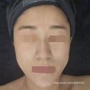 강남에스테틱 은브로우앤뷰티 겸스킨 피부관리 비대칭 작은얼굴 윤곽리프팅관리 후기