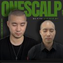 원스칼프 이미지