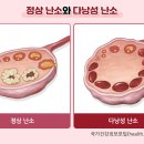 연세더좋은산부인과의원 네이버블로그