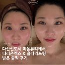 다산2동주민센터 1층 | 다산신부관리/다산다이어트/다산피부관리 미올뷰티에서 티리온엑스 &amp; 올다리프팅 받은 솔직 후기