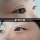 코코로스킨