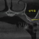 조앤최서울치과 이미지