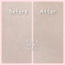 미모던피부과의원 | 모공치료추천 "쥬베룩 포텐자" 강남모공레이저 후기