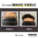 블랙인스칼프 이미지