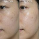 민감 피부도 안심! 마이리에 씨-캄 리바이브 크림 미백 주름 이중기능성 후기