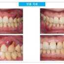 다짐치과의원 네이버블로그
