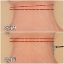 필라테스 본(BONE) | 마곡에스테틱 상체 바디관리 세심한 근본림가 후기