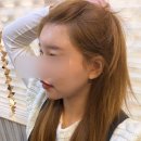 뉴서울의원 | 성수 뉴엘라인의원 / 성수 이마 필러 / 뚝섬 이마 필러 / 이마필러후기