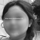 비포앤애프터의원 | 압구정누의원 신부관리 3회차 내돈내산 비포앤애프터 솔직후기