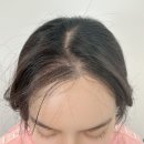 바이로마드 후기｜성신여대두피관리, 퇴근 후에도 편하게