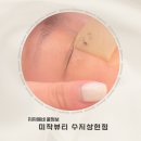상현약국 | [잡티제거] 미작뷰티 수지상현점 ㅣ 레이져 피부관리 가격, 후기