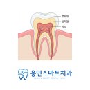 보정마디의원 | 용인충치치료 아프기 전에 치료해야 하는 이유. 충치는 절대 기다려주지 않습니다.