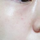 판교 피부관리 맞춤형 피부관리 잘하는 르뮤 에스테틱 솔직후기