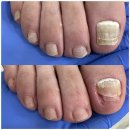 네일이룸(Nail eroom) | 울산 구영리 발톱무좀 잘하는 곳 네일이룸 페디크루 울산점