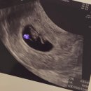 (주)대한표준가스 | [임신일기] (배란 11일차~21일차) 임신 4주~9주 후기