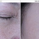 삼성더블의원 네이버블로그