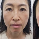 라라뷰티 이미지