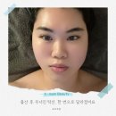 이연뷰티 - 전주시 덕진구 | 김포 피부관리 추천｜출산 후 무너진 턱선, 이연 에스테틱 솔직 후기