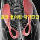 웃음과 유익한정보 골반 틀어짐 자가진단 이미지