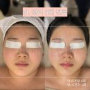 미니뷰티 이미지