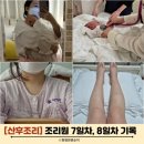 산후조리원 7일~8일차 부종 감소 및 수술부위 통증 완화