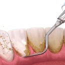 엔젤치과의원 이미지